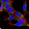 Alpha-Methylacyl-CoA Racemase antibody, LS-C812494, Lifespan Biosciences, Western Blot image 