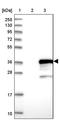 Metabolism Of Cobalamin Associated D antibody, PA5-57991, Invitrogen Antibodies, Western Blot image 
