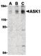 Mitogen-Activated Protein Kinase Kinase Kinase 5 antibody, PA5-20200, Invitrogen Antibodies, Western Blot image 