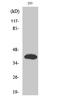 Insulin gene enhancer protein ISL-2 antibody, STJ93780, St John