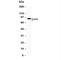 Activating Transcription Factor 6 antibody, R30180, NSJ Bioreagents, Western Blot image 