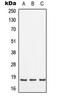 SFT2 Domain Containing 2 antibody, LS-C353683, Lifespan Biosciences, Western Blot image 