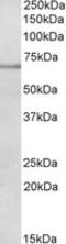 Terminal Nucleotidyltransferase 4B antibody, LS-C139789, Lifespan Biosciences, Western Blot image 