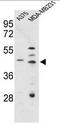 Cathepsin D antibody, AP51130PU-N, Origene, Western Blot image 