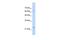 Troponin I1, Slow Skeletal Type antibody, GTX47076, GeneTex, Western Blot image 