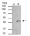 SET And MYND Domain Containing 3 antibody, GTX121956, GeneTex, Immunoprecipitation image 