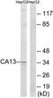 Carbonic Anhydrase 13 antibody, TA316395, Origene, Western Blot image 