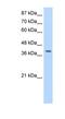 La-related protein 7 antibody, NBP1-57554, Novus Biologicals, Western Blot image 