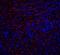 TNF Receptor Superfamily Member 10a antibody, GTX28414, GeneTex, Immunohistochemistry paraffin image 