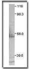 C-X-C Motif Chemokine Receptor 2 antibody, PA1-31217, Invitrogen Antibodies, Western Blot image 