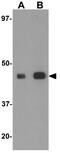 Isocitrate Dehydrogenase (NADP(+)) 1, Cytosolic antibody, GTX31417, GeneTex, Western Blot image 