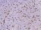 CD68 Molecule antibody, 11192-T26, Sino Biological, Immunohistochemistry paraffin image 