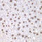 DNA Topoisomerase I antibody, 14-483, ProSci, Immunohistochemistry frozen image 