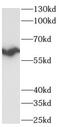 Ribosomal Protein S6 Kinase B2 antibody, FNab10317, FineTest, Western Blot image 