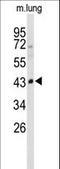 Sphingomyelin Phosphodiesterase 2 antibody, LS-C161320, Lifespan Biosciences, Western Blot image 