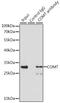 Catechol-O-Methyltransferase antibody, 14-710, ProSci, Immunoprecipitation image 