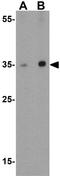 Secernin 3 antibody, GTX85171, GeneTex, Western Blot image 