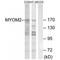 Myomesin 2 antibody, PA5-50064, Invitrogen Antibodies, Western Blot image 