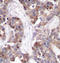 Stathmin 1 antibody, LS-C335880, Lifespan Biosciences, Immunohistochemistry paraffin image 