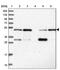 Makorin Ring Finger Protein 2 antibody, PA5-58004, Invitrogen Antibodies, Western Blot image 