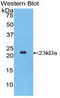 Interferon Alpha 2 antibody, LS-C299197, Lifespan Biosciences, Western Blot image 