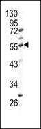 Glutamic--Pyruvic Transaminase antibody, PA5-14376, Invitrogen Antibodies, Western Blot image 