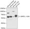 Sphingomyelin Phosphodiesterase 1 antibody, GTX64562, GeneTex, Western Blot image 