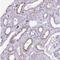 Transmembrane Protein 200C antibody, NBP2-30818, Novus Biologicals, Immunohistochemistry paraffin image 