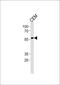 RUNX Family Transcription Factor 2 antibody, PA5-14816, Invitrogen Antibodies, Western Blot image 