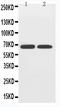 Solute Carrier Family 2 Member 12 antibody, LS-C313274, Lifespan Biosciences, Western Blot image 