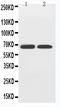 Solute carrier family 2, facilitated glucose transporter member 12 antibody, LS-C313274, Lifespan Biosciences, Western Blot image 