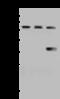 Propionyl-CoA Carboxylase Subunit Beta antibody, 202936-T40, Sino Biological, Western Blot image 