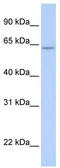 AT-Rich Interaction Domain 5A antibody, TA339849, Origene, Western Blot image 