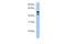 DEAF1 Transcription Factor antibody, A04189, Boster Biological Technology, Western Blot image 