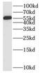 Cyclin Dependent Kinase Like 3 antibody, FNab05745, FineTest, Western Blot image 