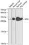Erythropoietin antibody, GTX33183, GeneTex, Western Blot image 