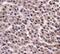 Pyruvate Kinase M1/2 antibody, PA5-23034, Invitrogen Antibodies, Immunohistochemistry paraffin image 