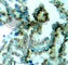 Protein Kinase C Beta antibody, AP0191, ABclonal Technology, Immunohistochemistry paraffin image 
