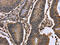 Decapping MRNA 1A antibody, CSB-PA086956, Cusabio, Immunohistochemistry paraffin image 