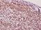 Synaptotagmin Binding Cytoplasmic RNA Interacting Protein antibody, A03946, Boster Biological Technology, Immunohistochemistry paraffin image 