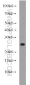 Cerebellin 2 Precursor antibody, 20558-1-AP, Proteintech Group, Western Blot image 
