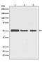 Tubulin Beta 3 Class III antibody, M01857, Boster Biological Technology, Western Blot image 