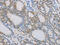 NCK Adaptor Protein 2 antibody, CSB-PA126963, Cusabio, Immunohistochemistry paraffin image 