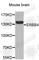 Erb-B2 Receptor Tyrosine Kinase 4 antibody, A6133, ABclonal Technology, Western Blot image 