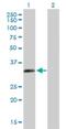Zinc Finger Protein 124 antibody, H00007678-B01P, Novus Biologicals, Western Blot image 