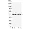 Interleukin 2 Receptor Subunit Gamma antibody, R30697, NSJ Bioreagents, Western Blot image 