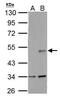 Wnt Family Member 1 antibody, GTX111182, GeneTex, Western Blot image 