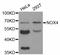 NADPH Oxidase 4 antibody, LS-C331983, Lifespan Biosciences, Western Blot image 
