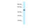 Minichromosome Maintenance 10 Replication Initiation Factor antibody, ARP36665_P050, Aviva Systems Biology, Western Blot image 