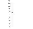 Tumor necrosis factor receptor superfamily member 25 antibody, R31111, NSJ Bioreagents, Western Blot image 